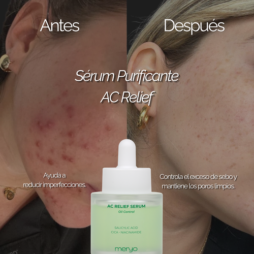 MERYO AC RELIEF SERUM